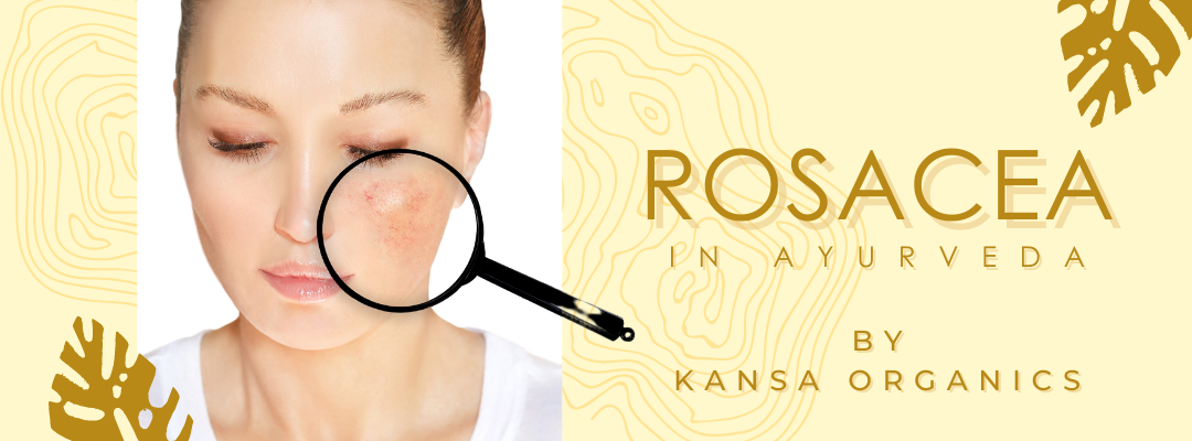 Is Ayurvedic Facial Oil safe for Rosacea?