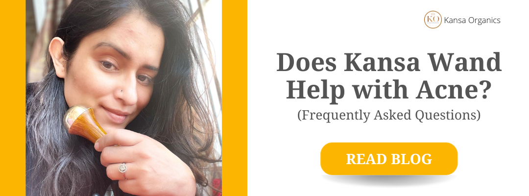 Does Kansa Wand Help with Acne?